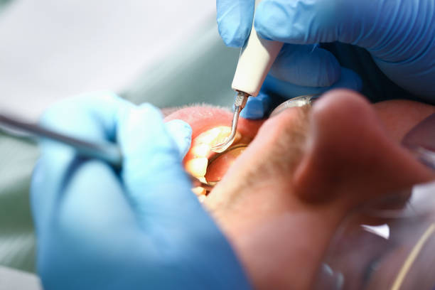 Best Cosmetic Emergency Dentistry in Mound Bayou, MS