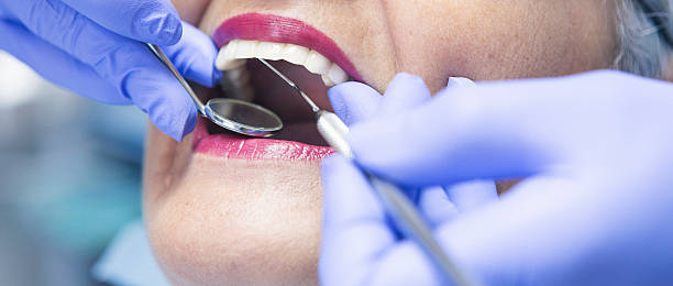 Best Emergency Wisdom Teeth Removal in Mound Bayou, MS